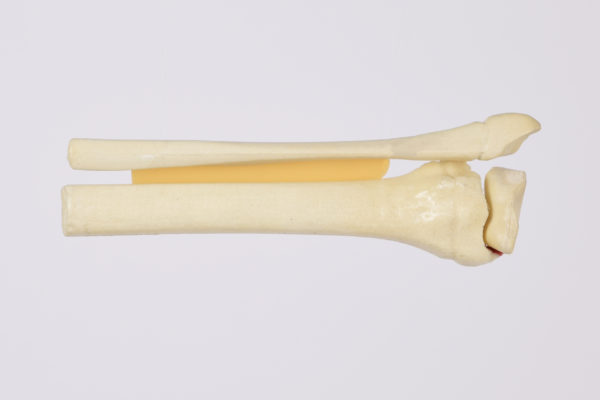 Orthopaedic Models for Surgical education