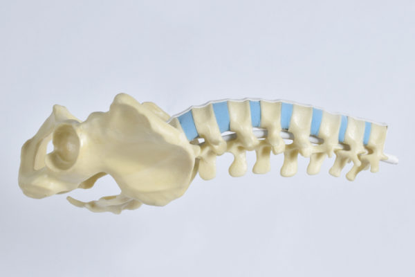Lumbar Spine with Pelvis
