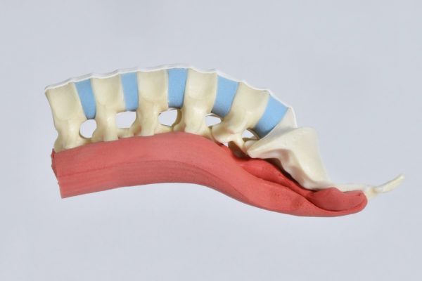 Lumbar spine with muscle