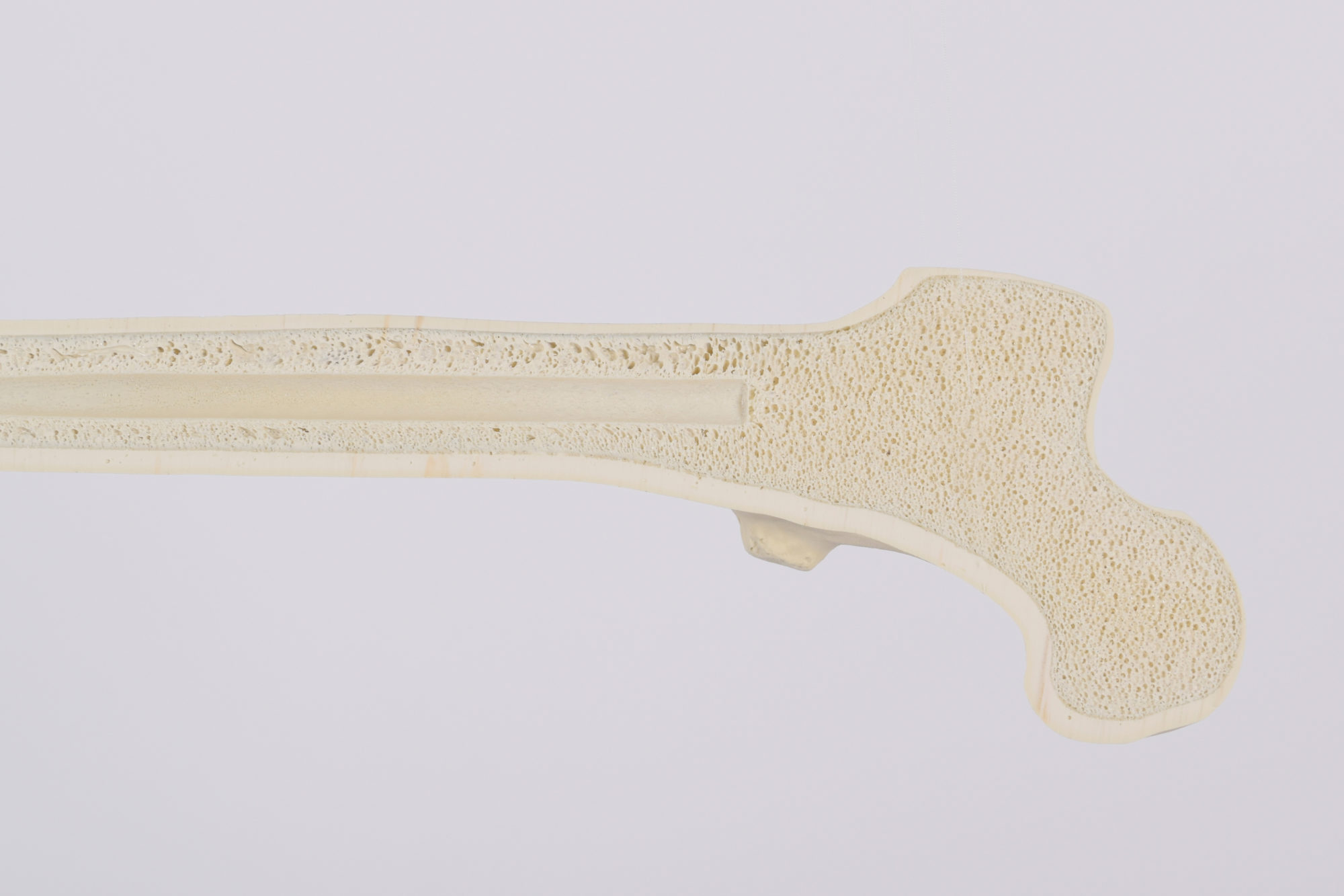 Cortical cancellous bone