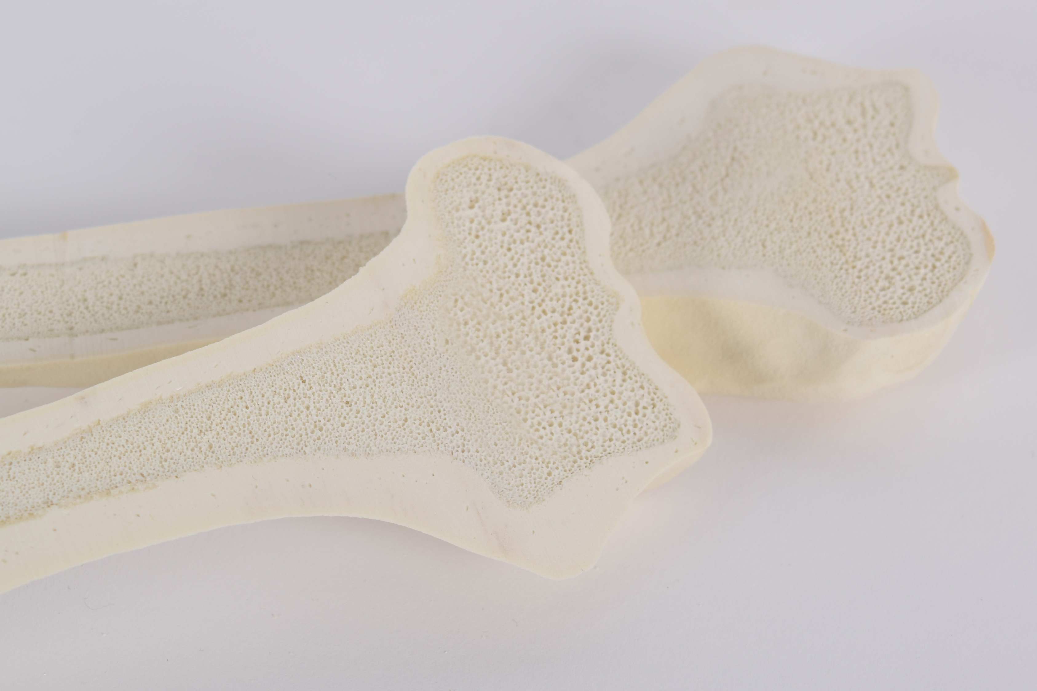 Humerus_5010