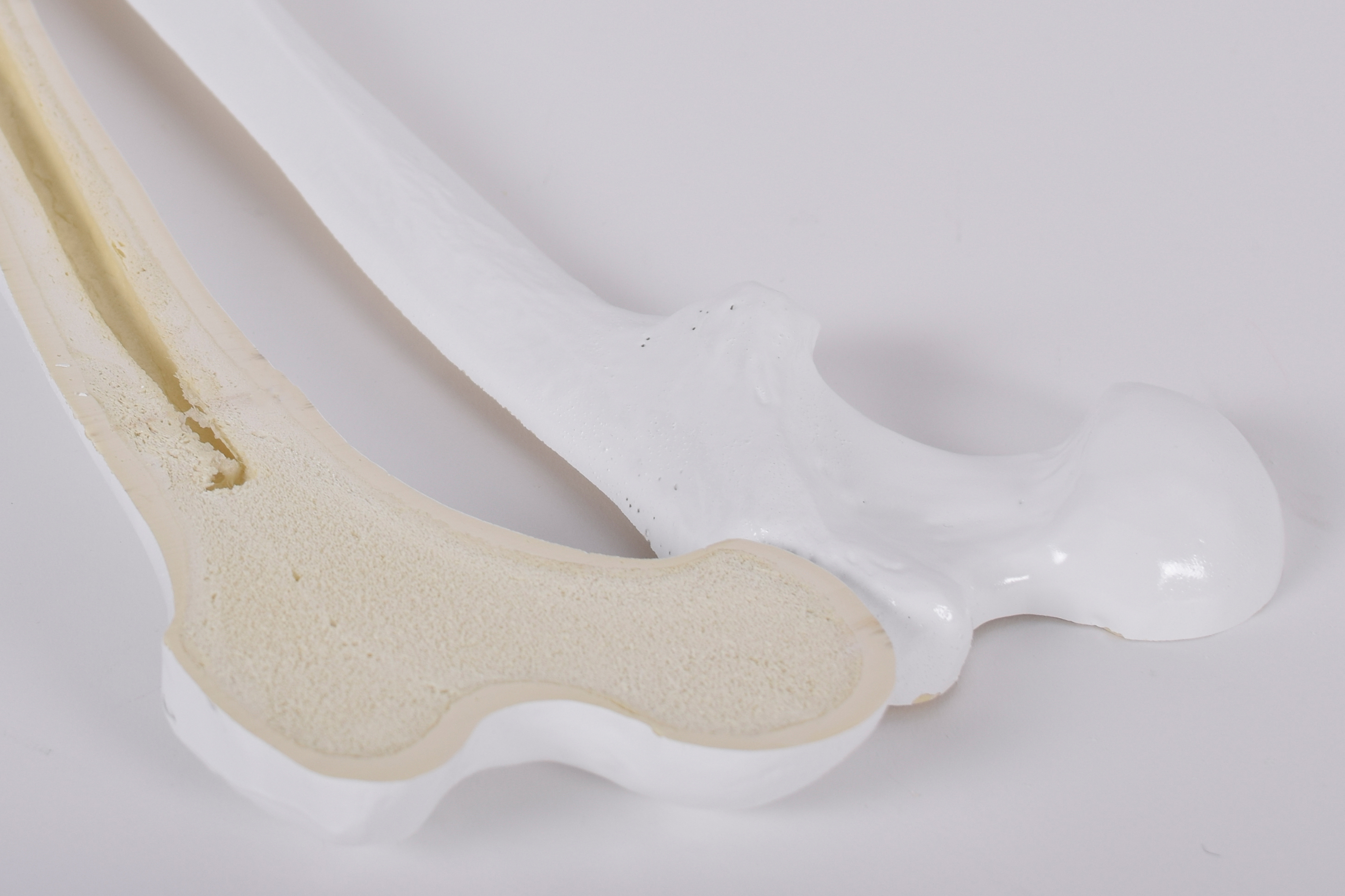 Femur_radiopaque_LS2169.9