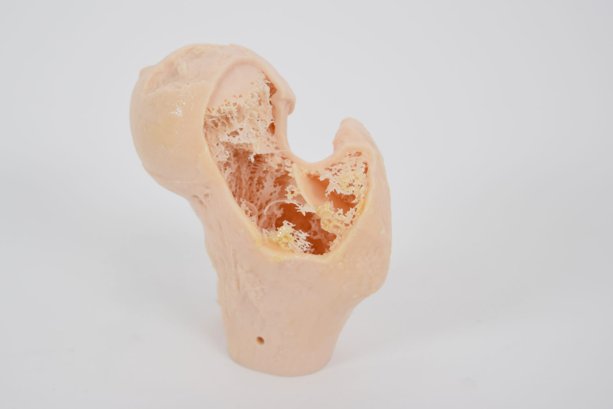 Osteoporotic-models Osteoprorotic models