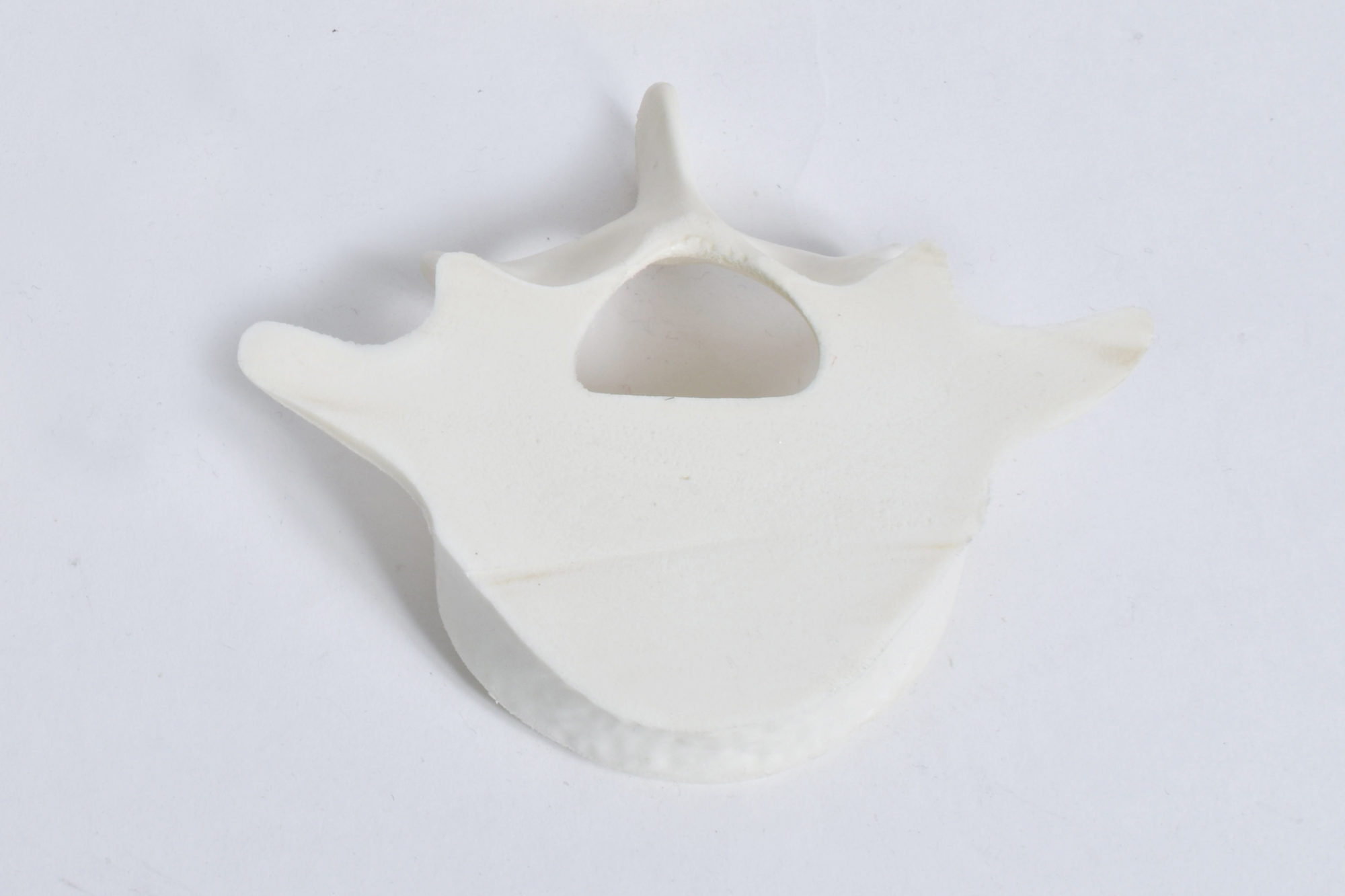 Vertebrae Solid Foam Model