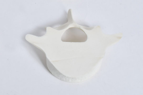 Vertebrae Solid Foam Model