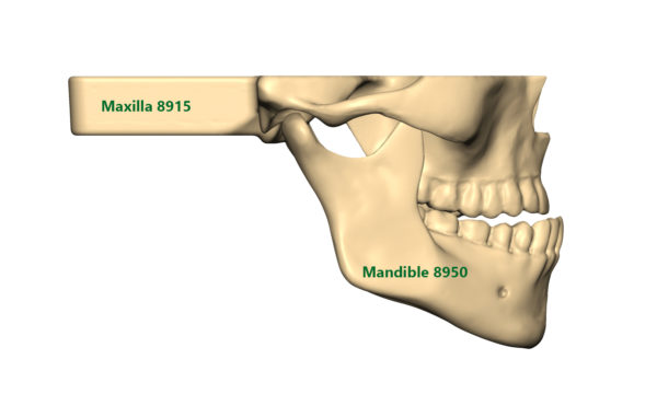 Underbite situation