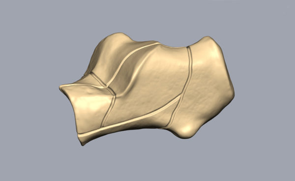 Transparent Calcaneus