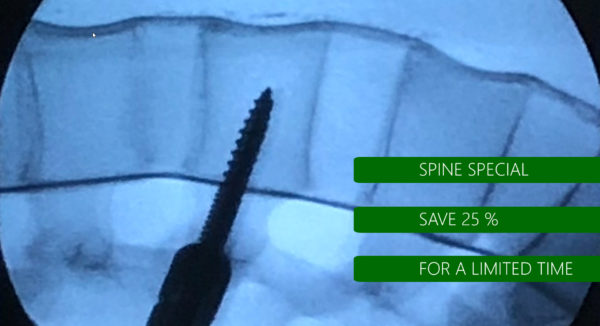 Spine Special for a limited time only - 25 % savings